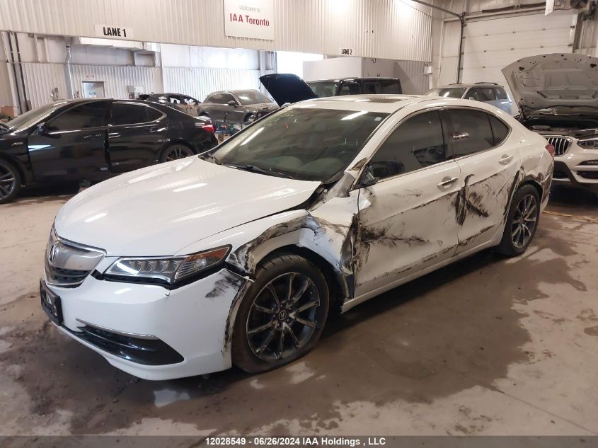 2017 Acura Tlx VIN: 19UUB3F36HA801506 Lot: 12028549