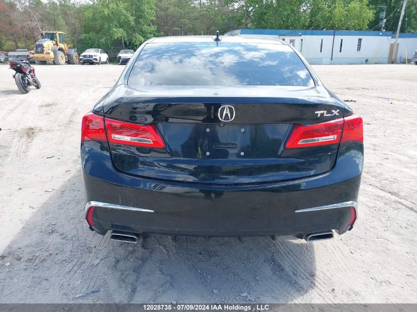 2018 Acura Tlx VIN: 19UUB1F54JA801290 Lot: 12028735