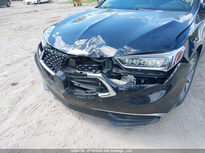 2018 Acura Tlx VIN: 19UUB1F54JA801290 Lot: 12028735