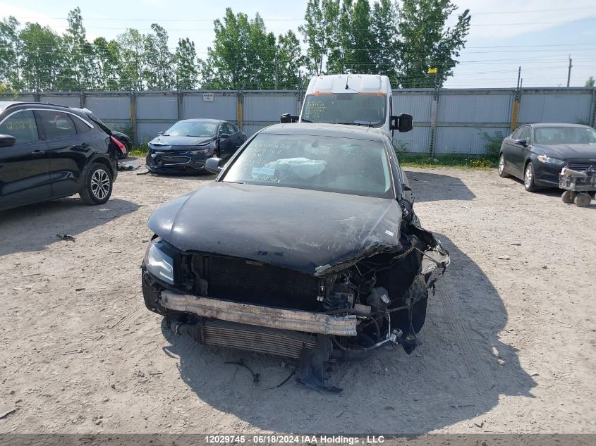 2011 Audi A4 VIN: WAUMFCFL0BN017628 Lot: 12029745