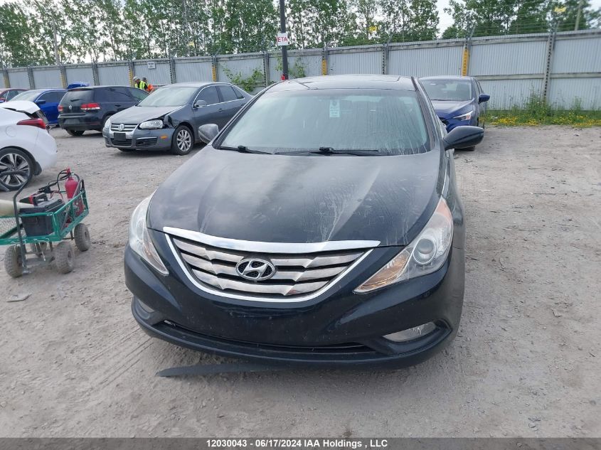 2012 Hyundai Sonata Gls VIN: 5NPEB4AC2CH409141 Lot: 12030043