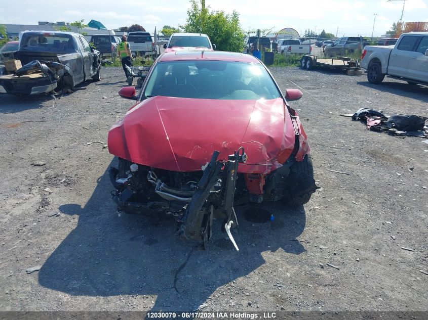 2022 Hyundai Elantra Ultimate Ivt With Tech Package VIN: KMHLN4AG8NU286855 Lot: 12030079