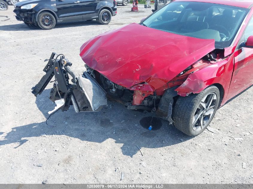 2022 Hyundai Elantra Ultimate Ivt With Tech Package VIN: KMHLN4AG8NU286855 Lot: 12030079