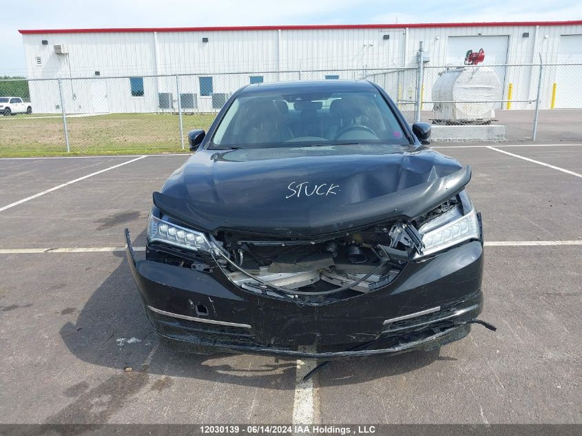 2015 Acura Tlx VIN: 19UUB2F59FA800617 Lot: 12030139