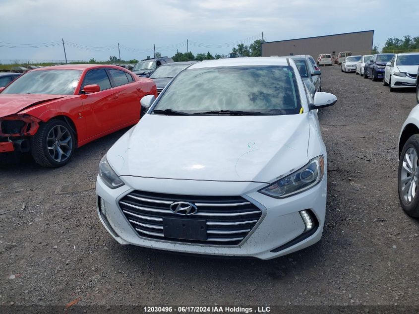 2017 Hyundai Elantra VIN: KMHD84LF4HU306412 Lot: 12030495