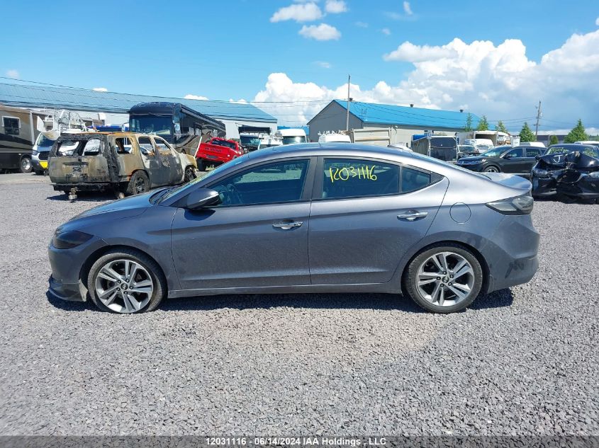 2017 Hyundai Elantra Se/Value/Limited VIN: KMHD84LF5HU314521 Lot: 12031116