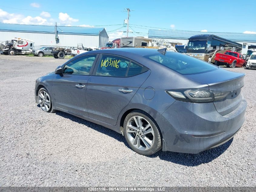 2017 Hyundai Elantra Se/Value/Limited VIN: KMHD84LF5HU314521 Lot: 12031116