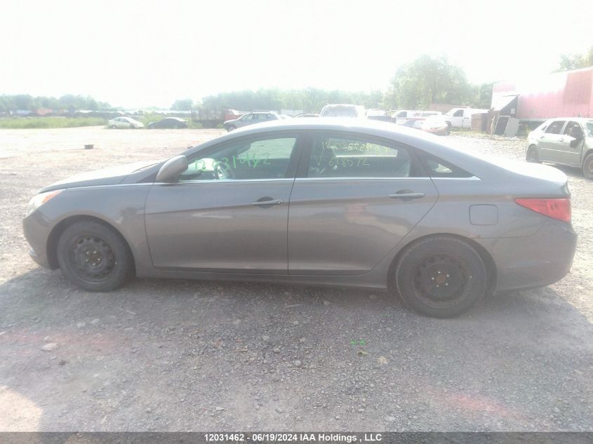 2013 Hyundai Sonata Se/Limited VIN: 5NPEC4AC5DH678572 Lot: 12031462