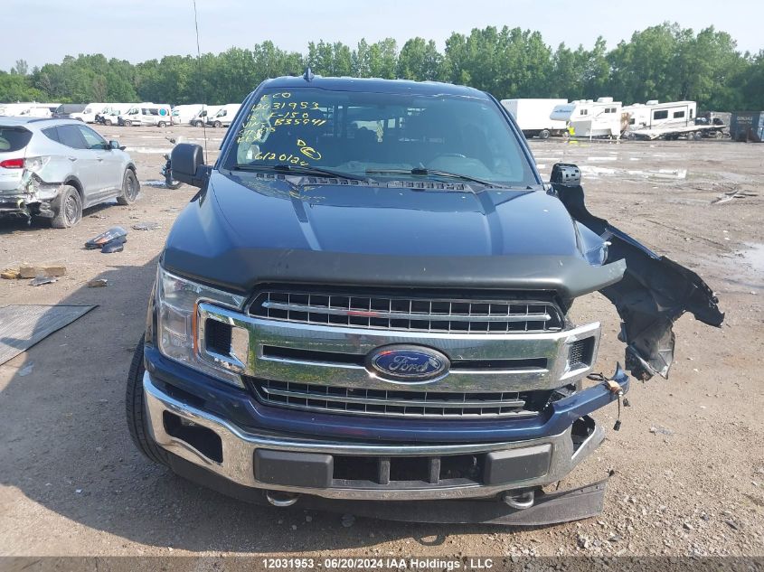 2018 Ford F-150 Xlt VIN: 1FTFW1E58JFB35941 Lot: 12031953