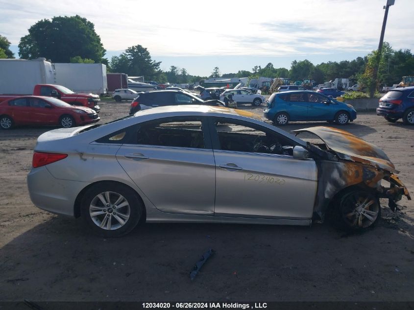 2013 Hyundai Sonata Gl/Gls VIN: 5NPEB4AC0DH725901 Lot: 12034020