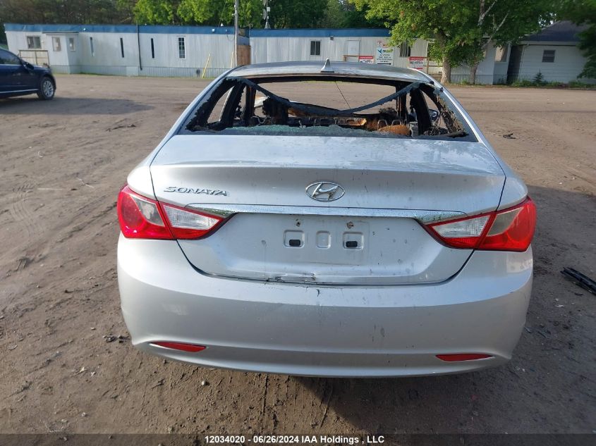 2013 Hyundai Sonata Gl/Gls VIN: 5NPEB4AC0DH725901 Lot: 12034020
