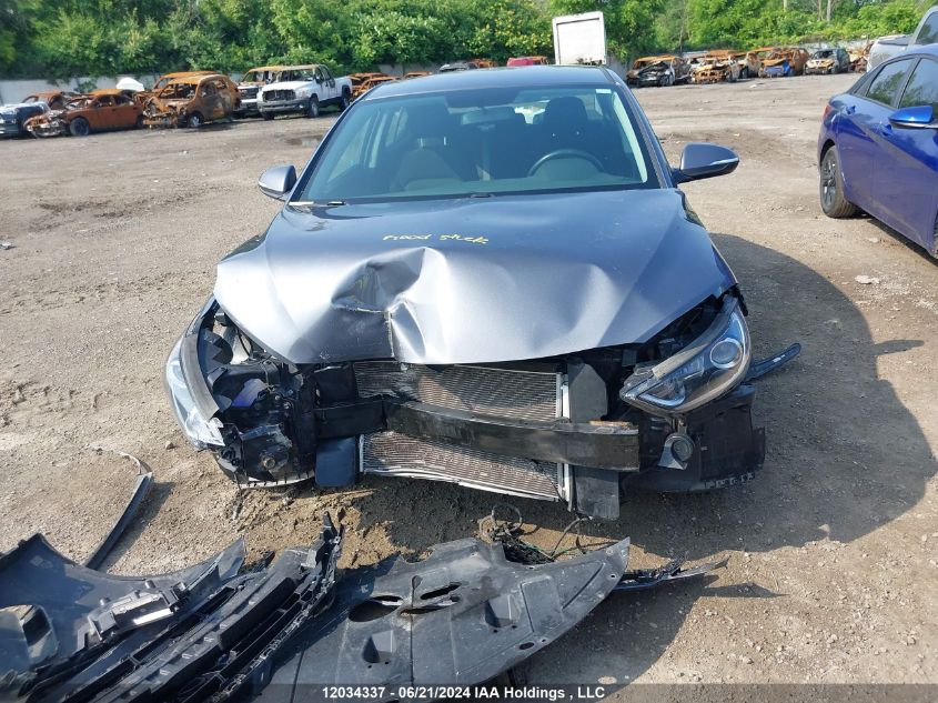 2017 Hyundai Elantra Se/Value/Limited VIN: KMHD84LF7HU399698 Lot: 12034337