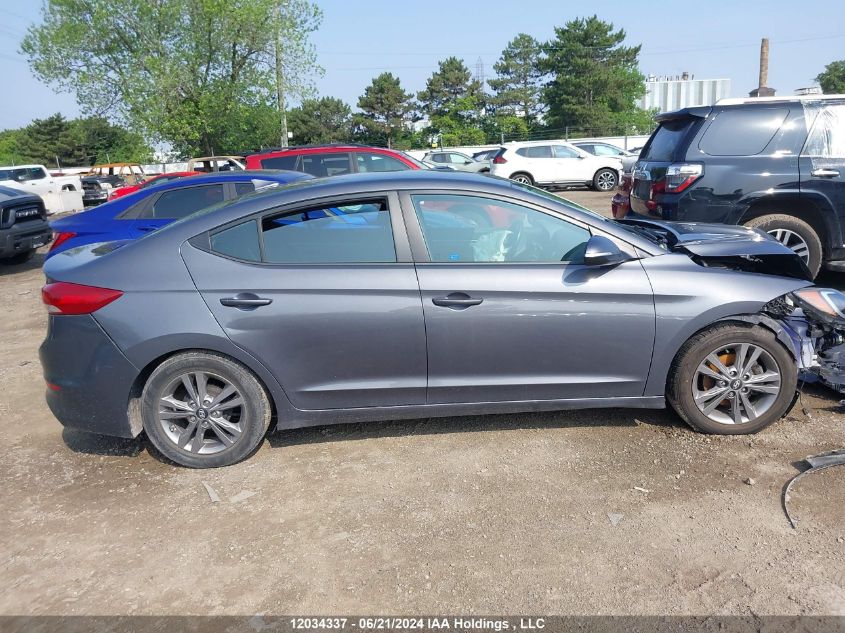 2017 Hyundai Elantra Se/Value/Limited VIN: KMHD84LF7HU399698 Lot: 12034337