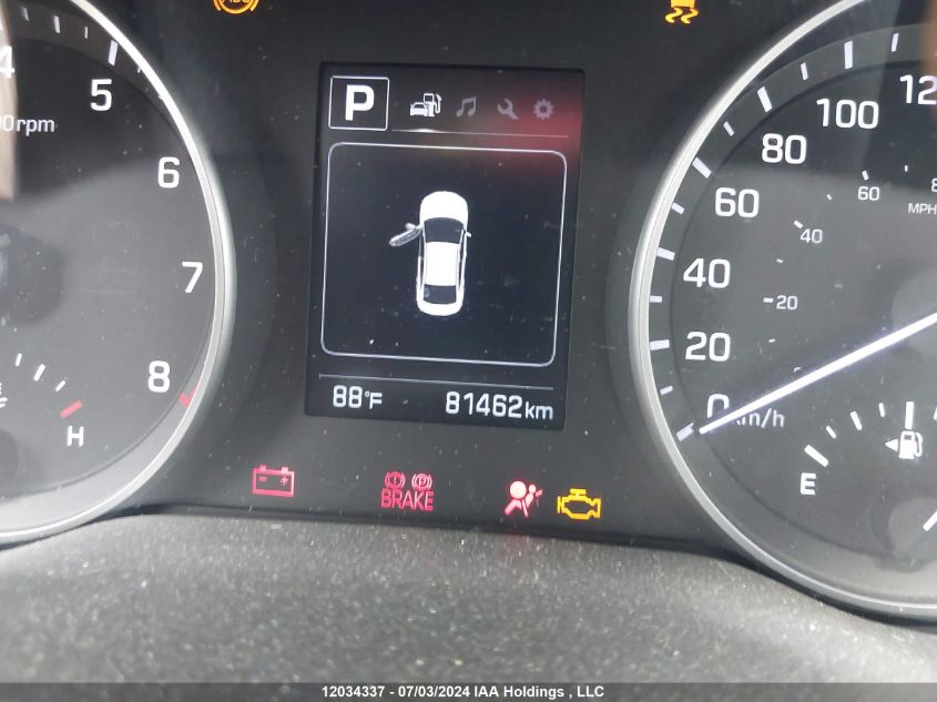 2017 Hyundai Elantra Se/Value/Limited VIN: KMHD84LF7HU399698 Lot: 12034337