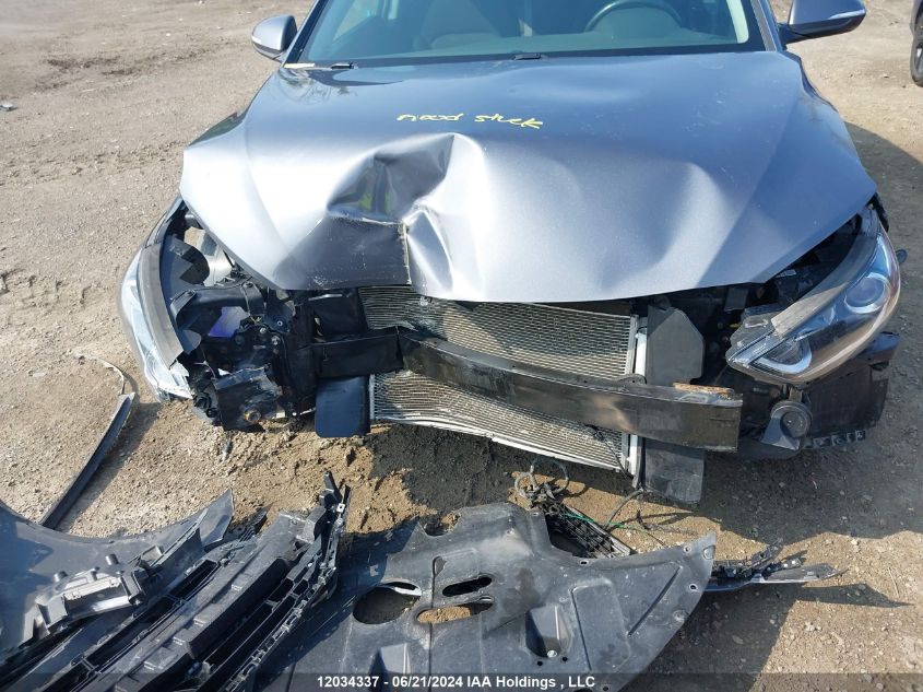 2017 Hyundai Elantra Se/Value/Limited VIN: KMHD84LF7HU399698 Lot: 12034337