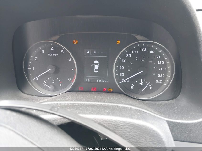 2017 Hyundai Elantra Se/Value/Limited VIN: KMHD84LF7HU399698 Lot: 12034337