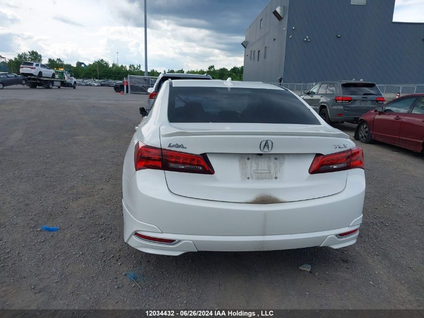 2015 Acura Tlx VIN: 19UUB1F31FA800264 Lot: 12034432