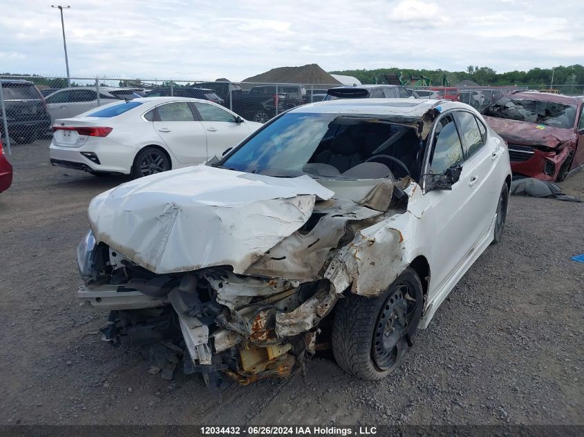 2015 Acura Tlx VIN: 19UUB1F31FA800264 Lot: 12034432