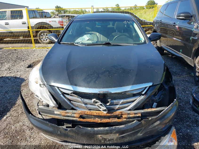 2013 Hyundai Sonata VIN: 5NPEB4AC2DH641661 Lot: 12034693
