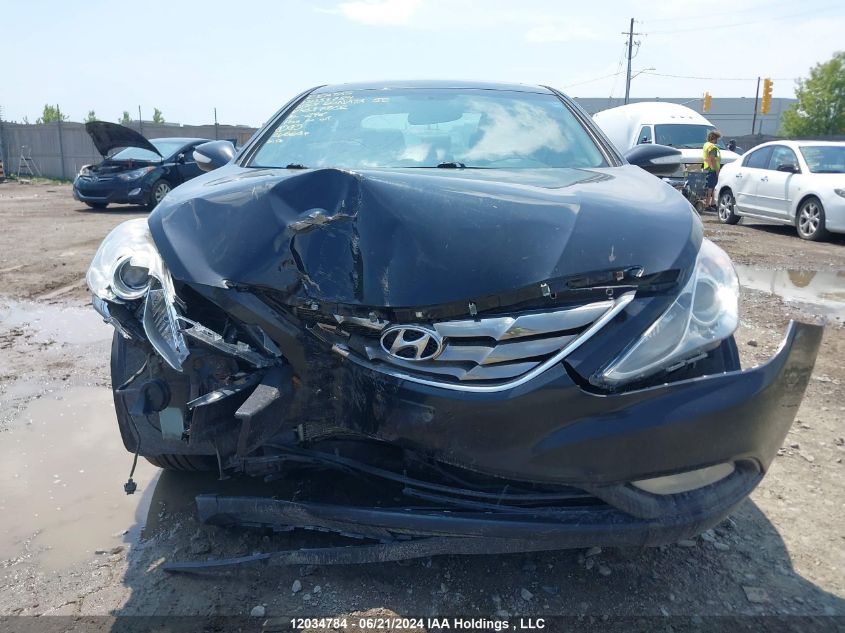 2013 Hyundai Sonata Se/Limited VIN: 5NPEC4ACXDH637502 Lot: 12034784