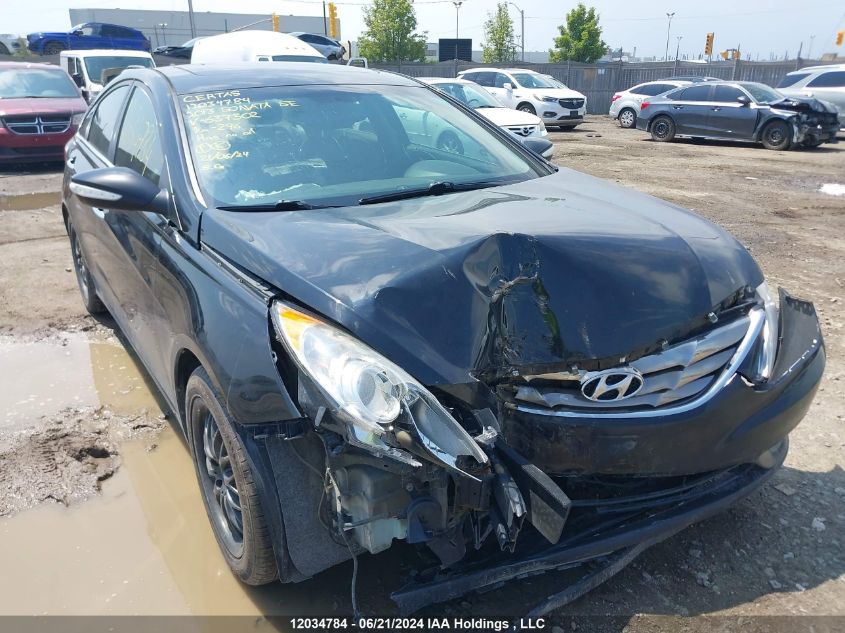 2013 Hyundai Sonata Se/Limited VIN: 5NPEC4ACXDH637502 Lot: 12034784