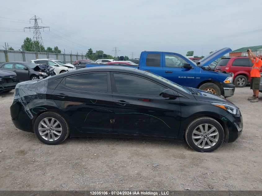 2015 Hyundai Elantra Se/Sport/Limited VIN: KMHDH4AE0FU417918 Lot: 12035106