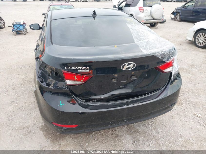 2015 Hyundai Elantra Se/Sport/Limited VIN: KMHDH4AE0FU417918 Lot: 12035106