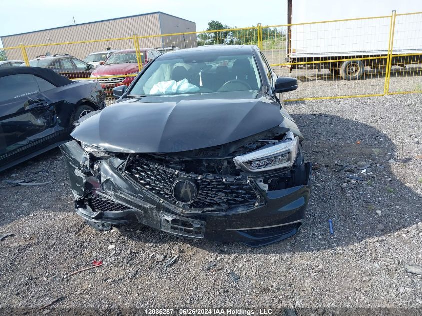 2018 Acura Tlx VIN: 19UUB1F30JA801334 Lot: 12035287