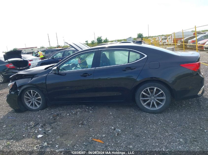 2018 Acura Tlx VIN: 19UUB1F30JA801334 Lot: 12035287