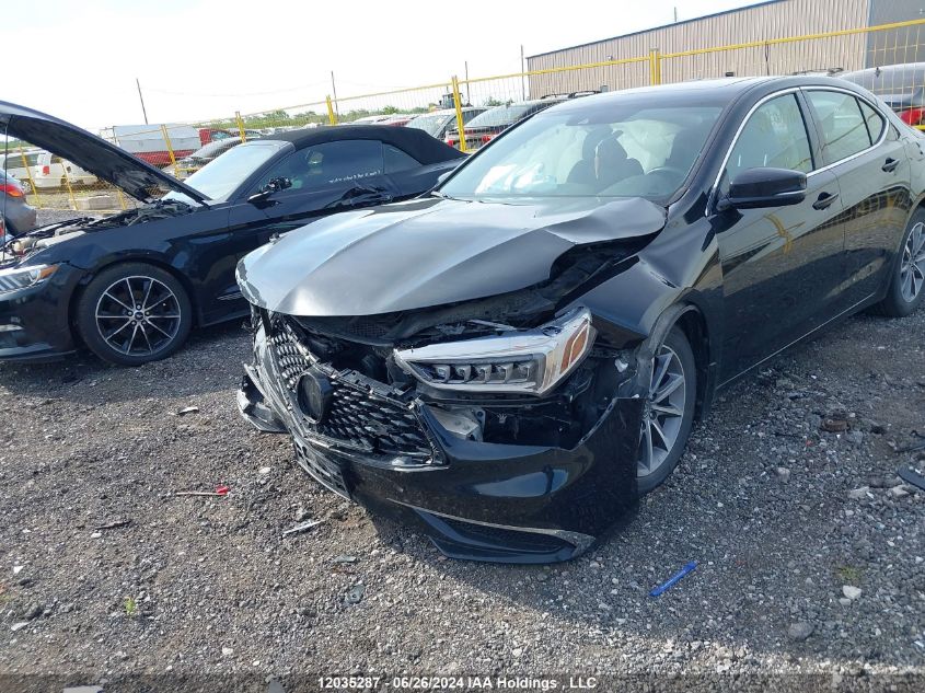 2018 Acura Tlx VIN: 19UUB1F30JA801334 Lot: 12035287