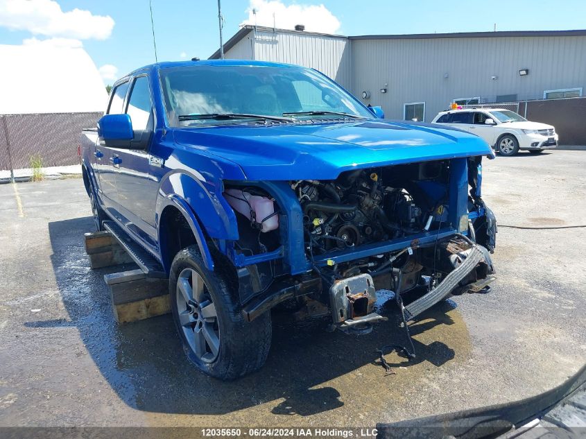 2017 Ford F150 Supercrew VIN: 1FTFW1EF2HFC65992 Lot: 12035650