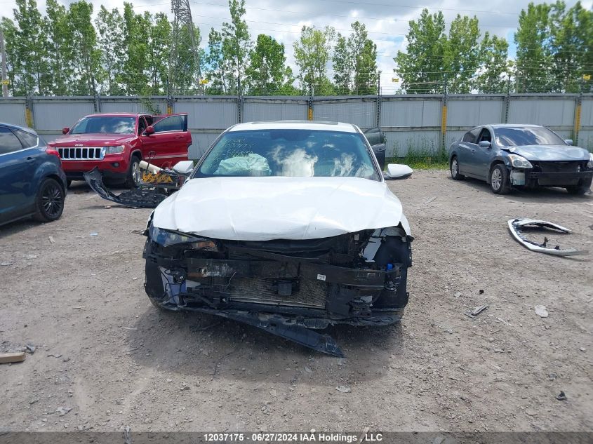 2022 Hyundai Elantra Ultimate Ivt With Tech Package VIN: KMHLN4AGXNU266347 Lot: 12037175