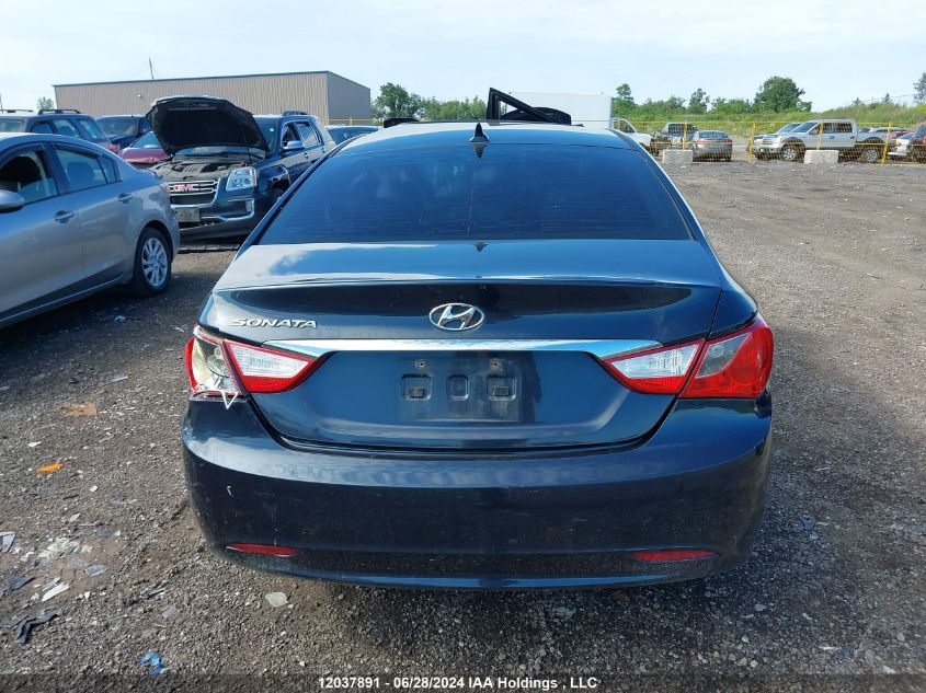 2011 Hyundai Sonata Gls VIN: 5NPEB4AC5BH260786 Lot: 12037891