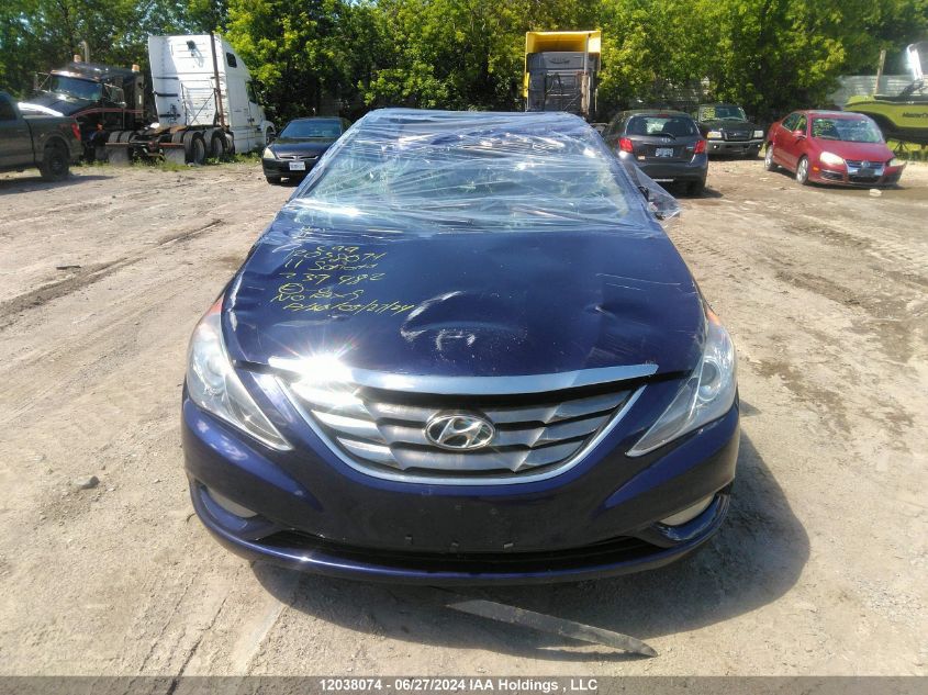 2011 Hyundai Sonata Gls VIN: 5NPEB4ACXBH239982 Lot: 12038074