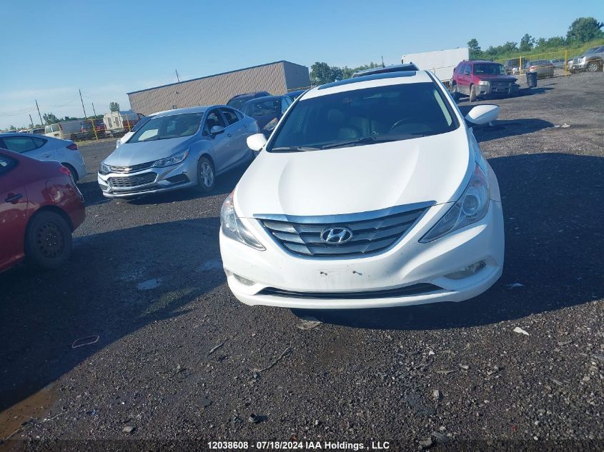 2013 Hyundai Sonata Se/Limited VIN: 5NPEC4AC2DH679453 Lot: 12038608