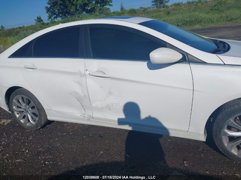 2013 Hyundai Sonata Se/Limited VIN: 5NPEC4AC2DH679453 Lot: 12038608