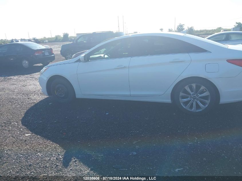 2013 Hyundai Sonata Se/Limited VIN: 5NPEC4AC2DH679453 Lot: 12038608