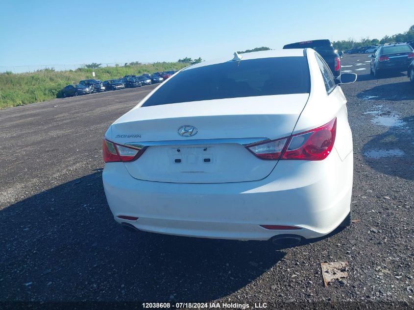 2013 Hyundai Sonata Se/Limited VIN: 5NPEC4AC2DH679453 Lot: 12038608