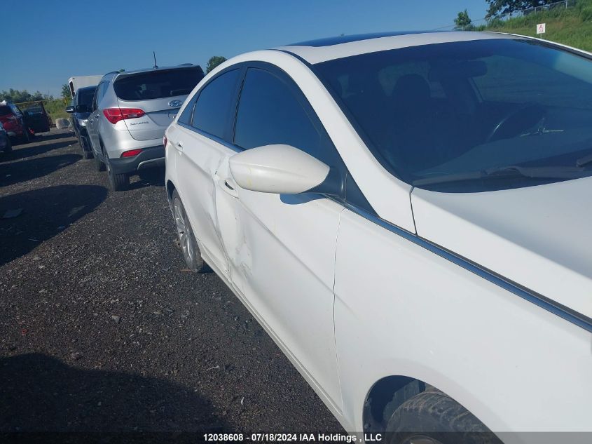 2013 Hyundai Sonata Se/Limited VIN: 5NPEC4AC2DH679453 Lot: 12038608