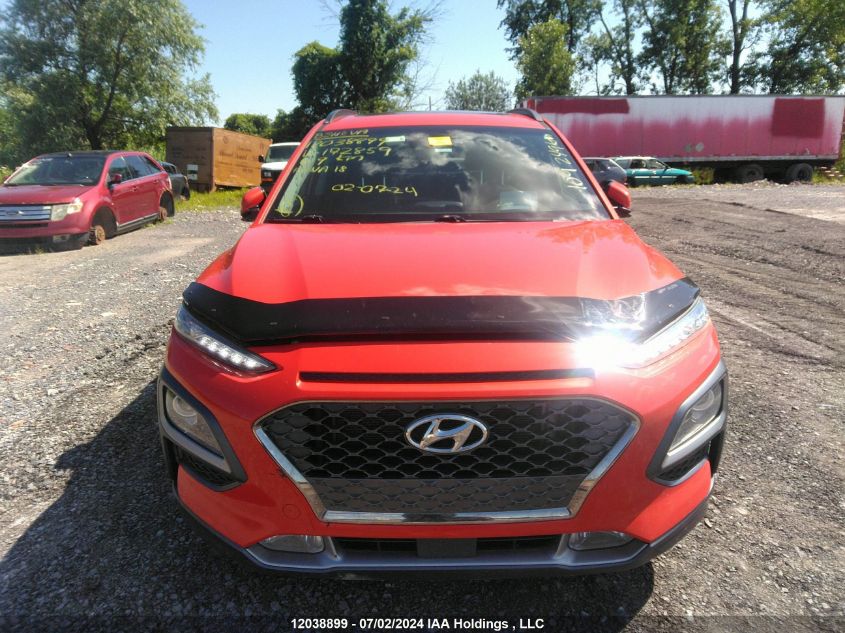 2018 Hyundai Kona 1.6T Ultimate VIN: KM8K5CA57JU172859 Lot: 12038899