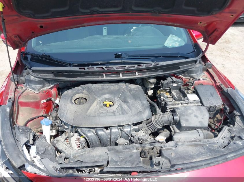 2017 Kia Forte VIN: 3KPFL4A86HE093932 Lot: 12039196