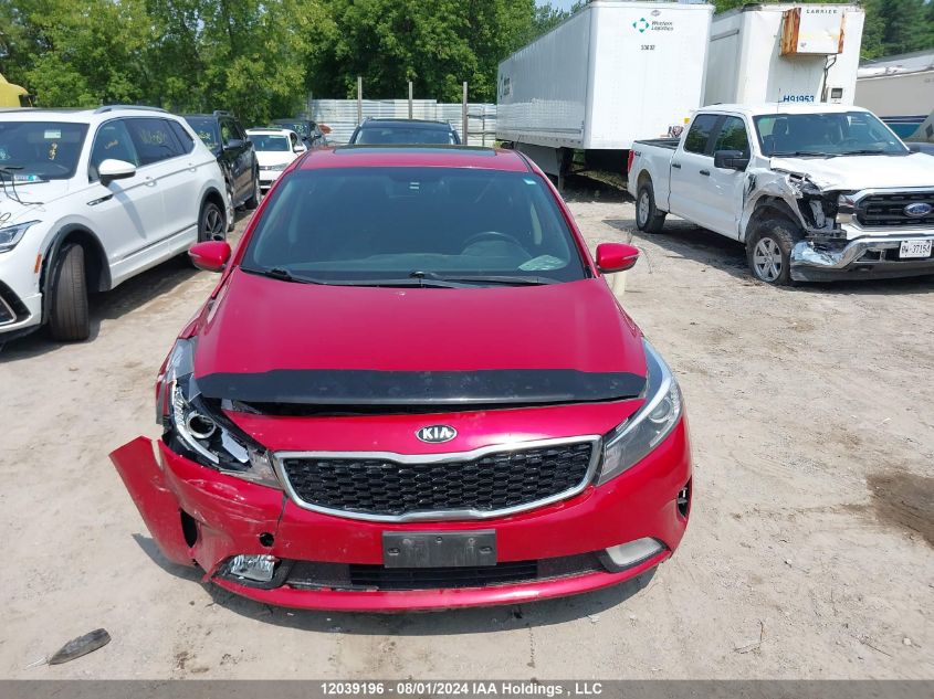 2017 Kia Forte VIN: 3KPFL4A86HE093932 Lot: 12039196