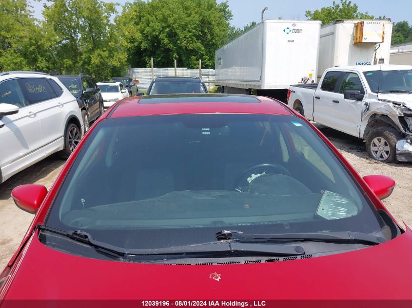 2017 Kia Forte VIN: 3KPFL4A86HE093932 Lot: 12039196