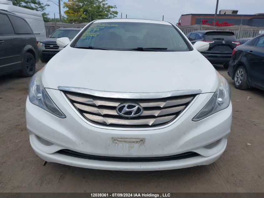 2012 Hyundai Sonata Gls VIN: 5NPEB4AC2CH451244 Lot: 12039361