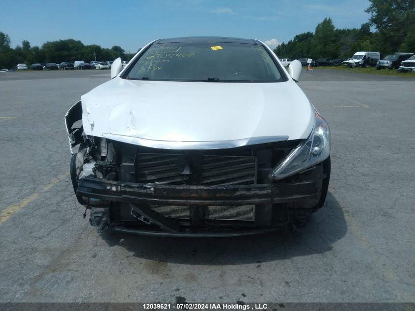 2013 Hyundai Sonata Se/Limited VIN: 5NPEC4AC4DH805408 Lot: 12039621