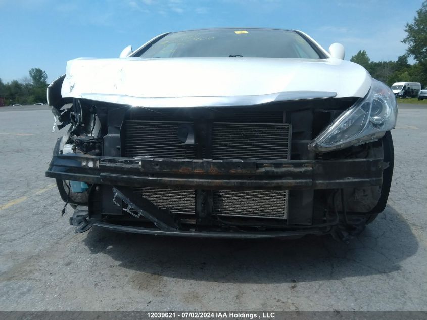 2013 Hyundai Sonata Se/Limited VIN: 5NPEC4AC4DH805408 Lot: 12039621