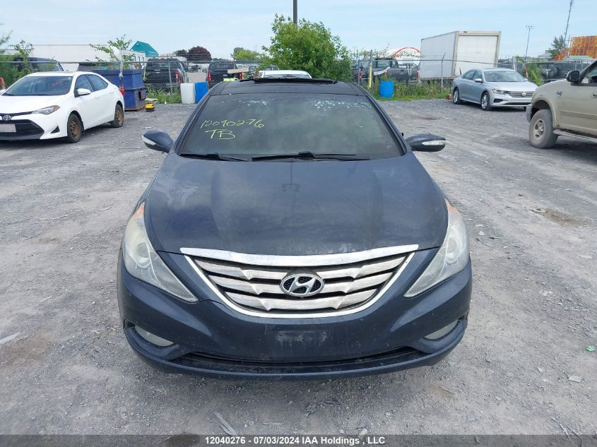 2013 Hyundai Sonata Se/Limited VIN: 5NPEC4AC8DH776642 Lot: 12040276