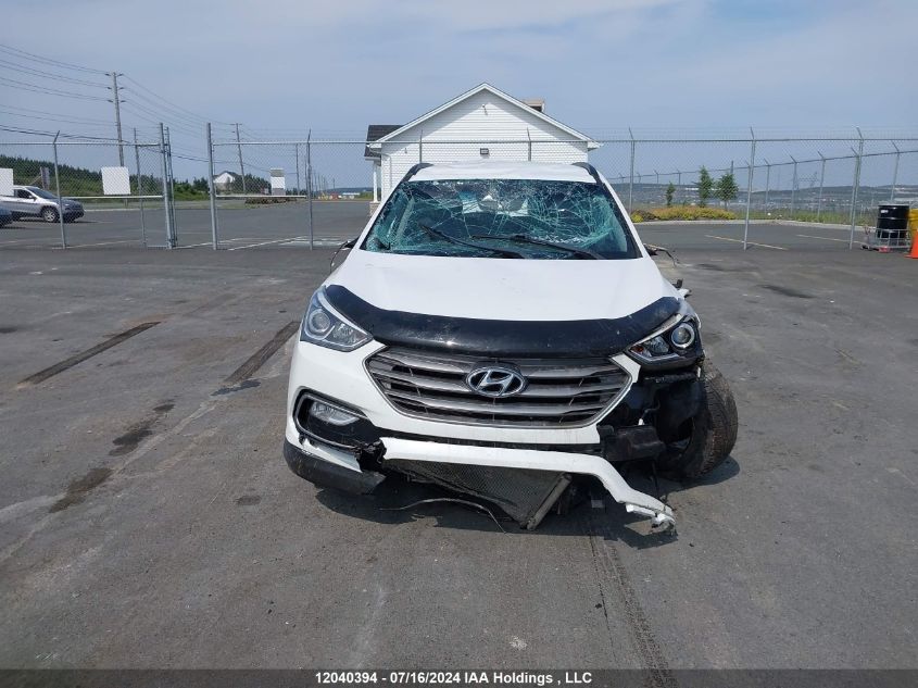 2017 Hyundai Santa Fe Sport VIN: 5XYZUDLB6HG477750 Lot: 12040394