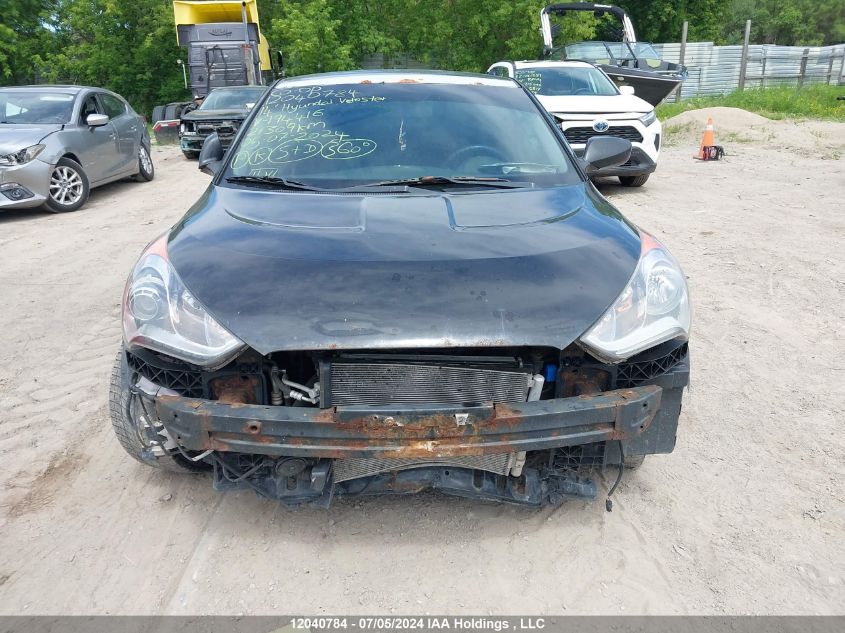 2014 Hyundai Veloster VIN: KMHTC6AD5EU194416 Lot: 12040784