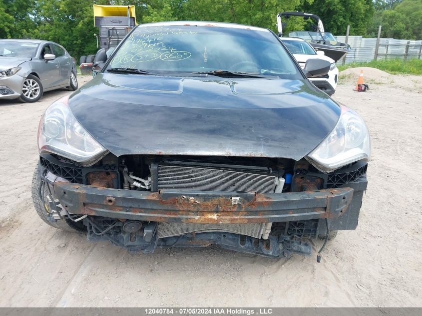 2014 Hyundai Veloster VIN: KMHTC6AD5EU194416 Lot: 12040784